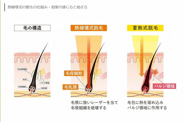 熱破壊式と蓄熱式の違い